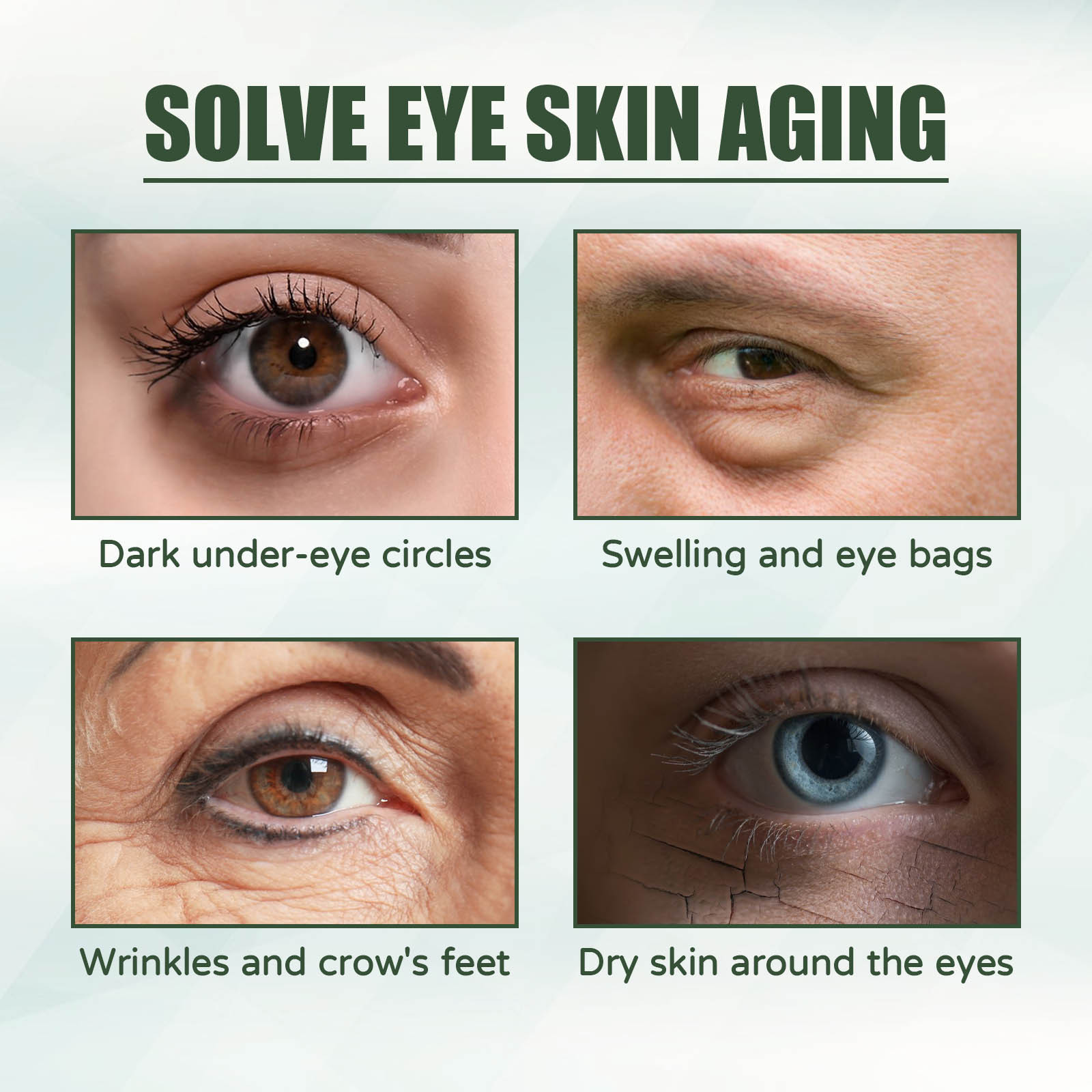 EELHOE Anti Aging Eye Cream Re - đánh giá và giá Women Bags Under Eyes