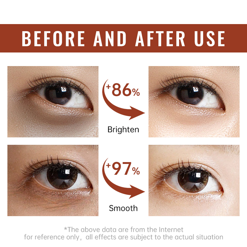 Retinol Firming Eye Cream Anti - đánh giá và giá Women Bags Under Eyes